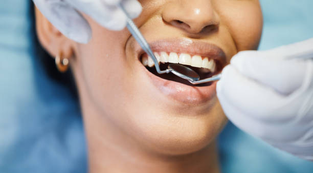 Best After-Hours Emergency Dentist in Nebo, NC